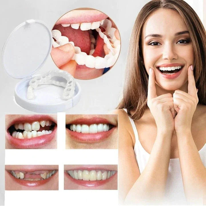 Moktan Sabai LumaGrin Snap-On Veneers Upper & Lower Teeth, Removable Smile Cover